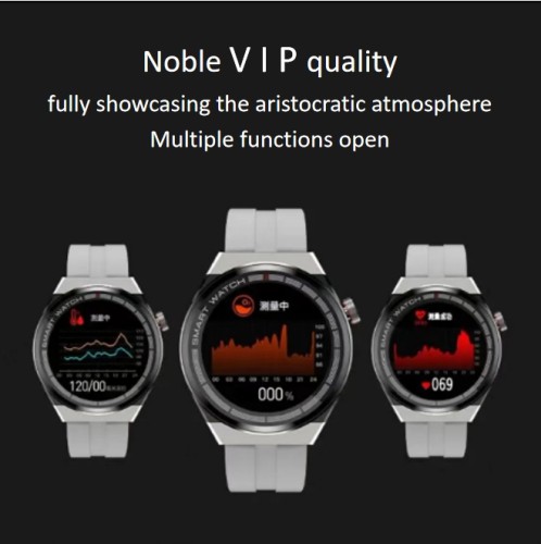 VIP personalized custom-made watch*3
